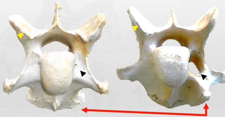 Webinar: Update your knowledge about ECVM (Equine Complex Vertebral ...